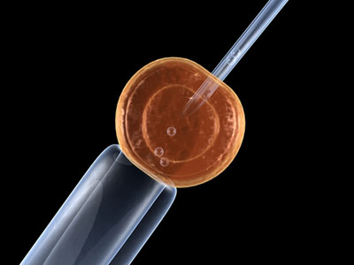  suited embryo for insemination. In Vitro Fertilization (IVF) and other 
